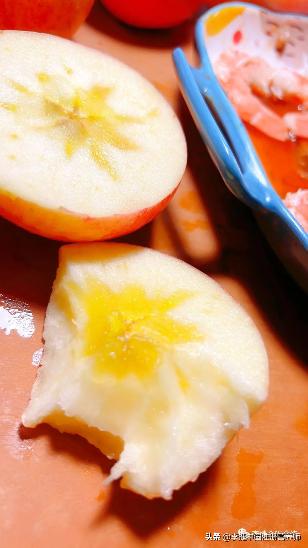 膳食纤维糖有用吗,膳食纤维丰富有益健康