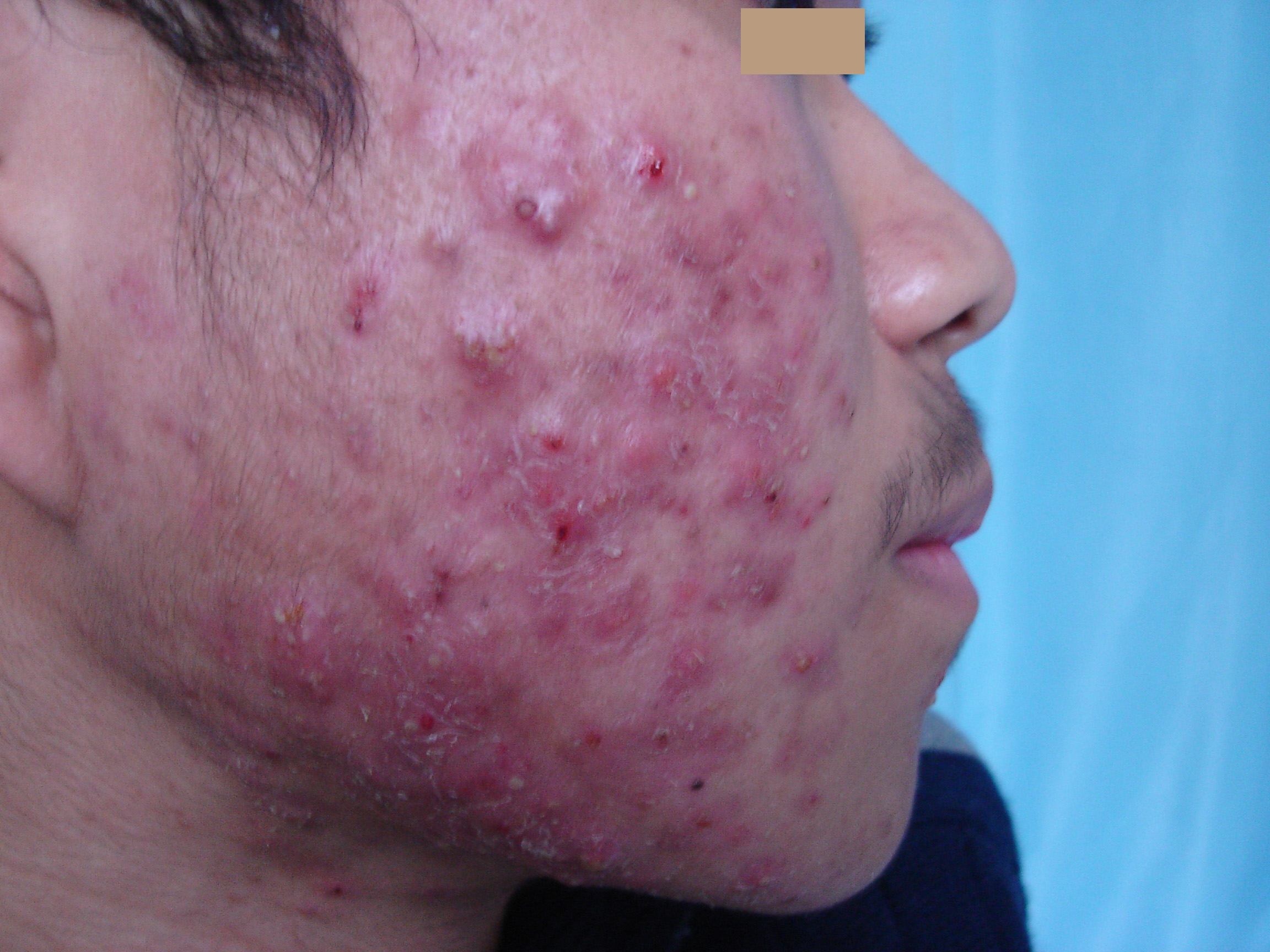 生活方式病是什么,生活方式治生活方式病干预方案