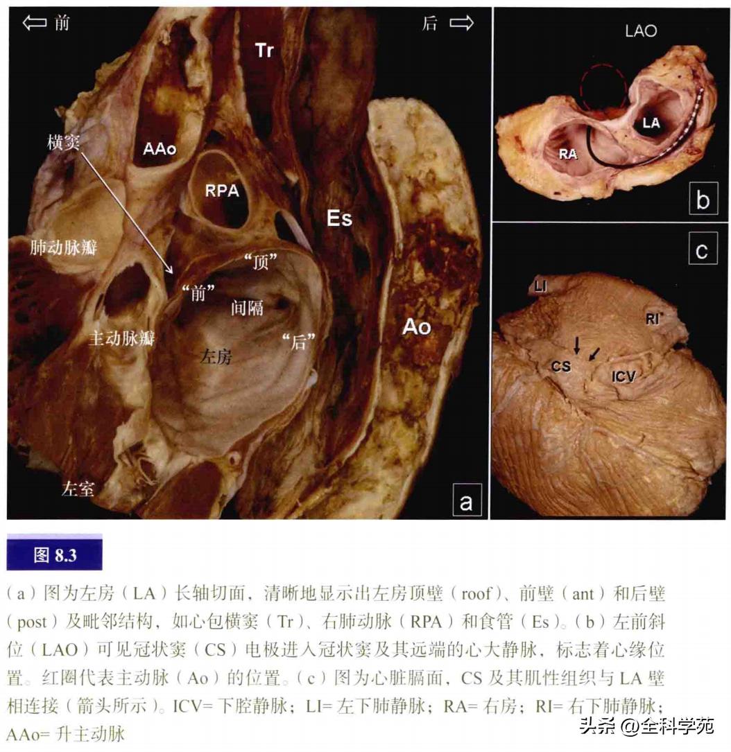连接左心房的是肺静脉吗,左心房与肺静脉解剖