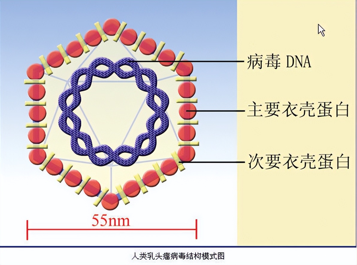 病毒性“性病”:尖锐湿疣「重组人干扰素α2b*剂喷**敷料」辅助治疗
