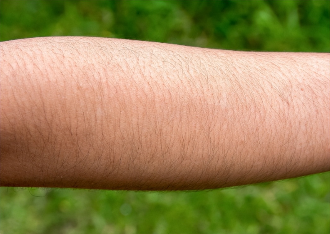 女性身上毛发旺盛什么原因呢,女性身上毛发旺盛什么原因