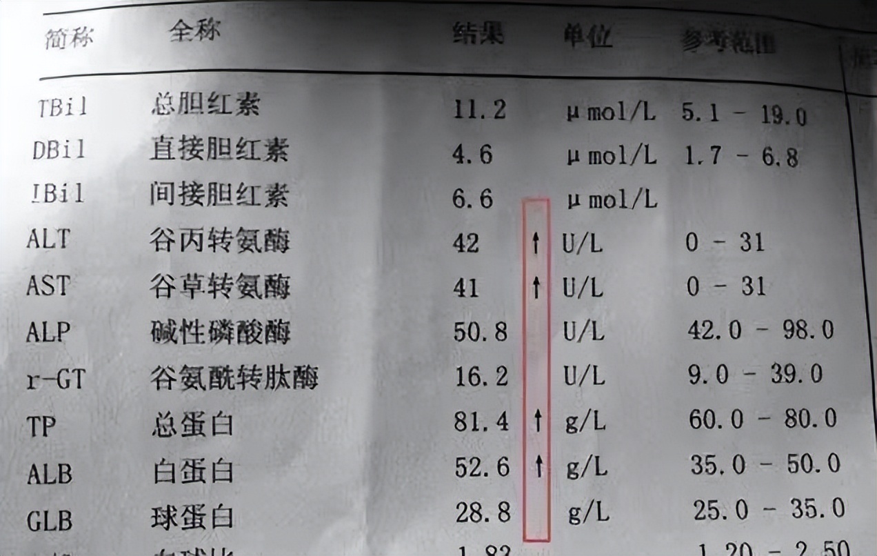 献血肝功能偏高怎么降下来,小孩肝功能有点偏高怎么降下来