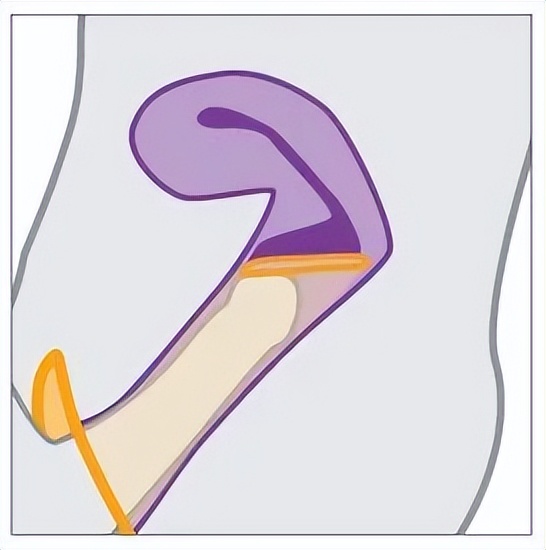 套套只能男人用？