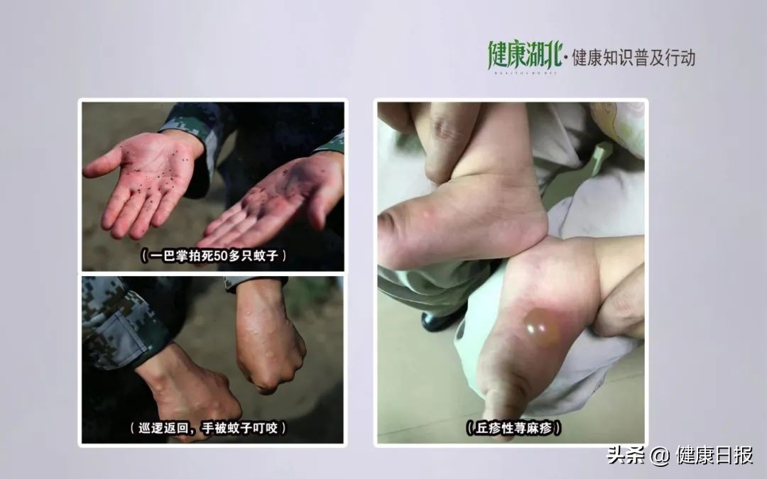 皮肤病的问题全在这里,皮肤病的10大问题