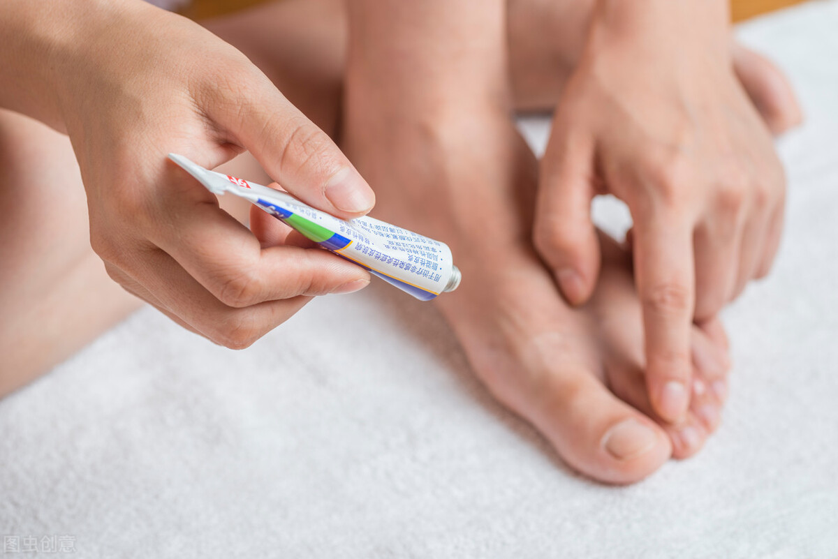 手足癣真菌感染最佳治疗方法,真菌手足癣内服药