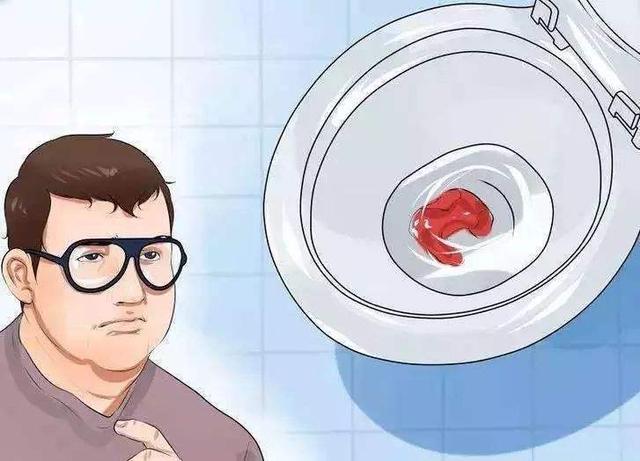 如何区分痔疮出血与直肠癌出血,直肠癌便血与痔疮便血的区分