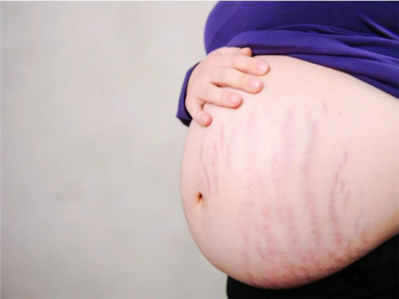 孕妇吃燕窝会导致胎儿长胖吗,孕妇可以吃燕窝会上火吗