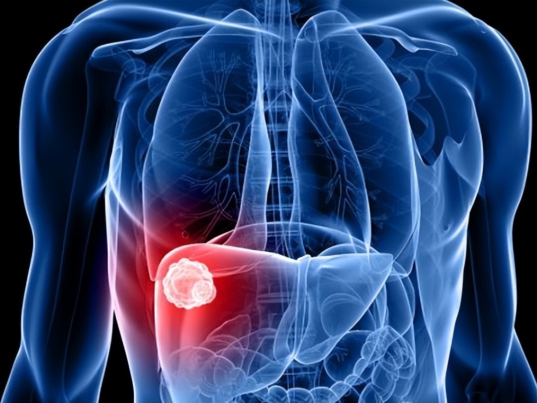 肝区疼痛不适可能是这6种情况,肝区疼痛有9大原因