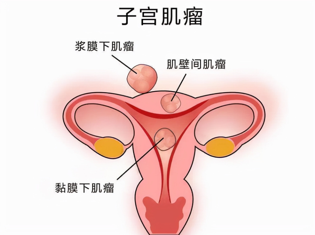 绝经后又来月经与活血药有关吗,绝经后又来月经会不会腰疼