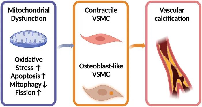 血管钙化的机制是什么,血管钙化如何治疗吃什么中成药