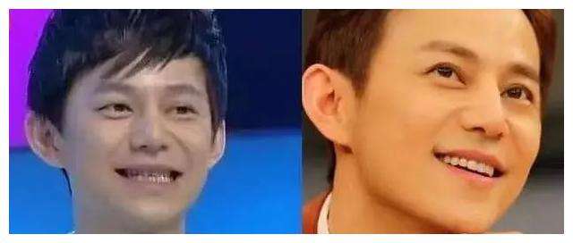 明星做烤瓷牙变凸嘴,明星烤瓷牙凸嘴