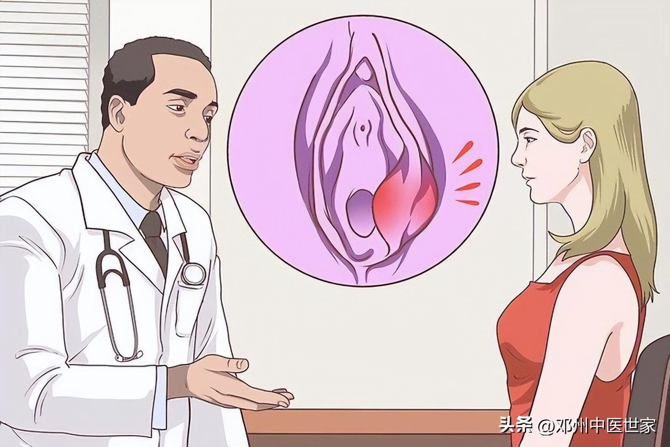 前庭大腺囊肿中药贴敷效果如何,治疗前庭大腺炎的药物