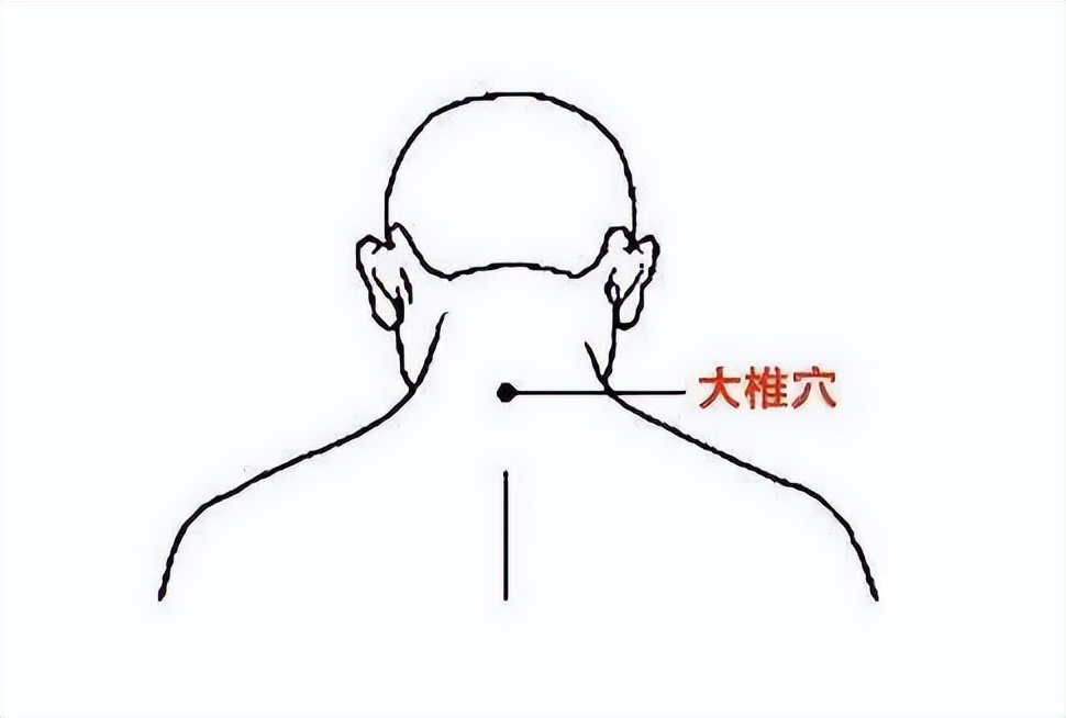 寒则凝则瘀则堵,寒则凝湿则堵是什么意思