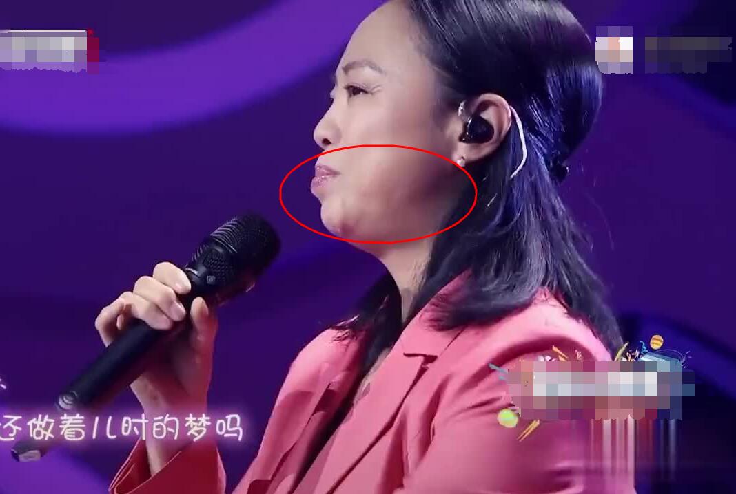 同样都是“凸嘴”，为什么有人风情万种，有人一股土味？答案在这