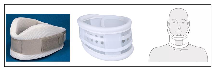 颈椎病是什么病要怎么治,颈椎病是怎样的症状