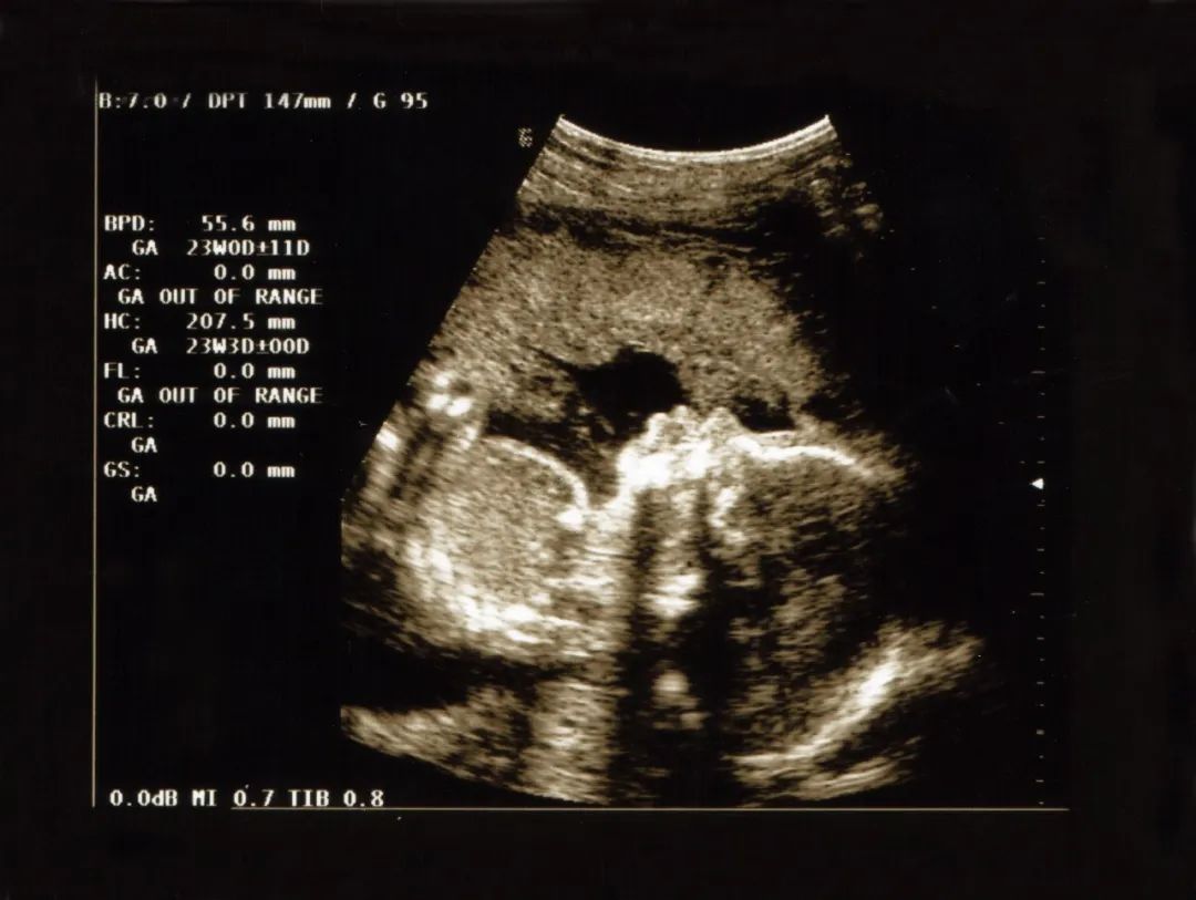 苍井空：怀孕2个月胎停，我感觉天都要塌了