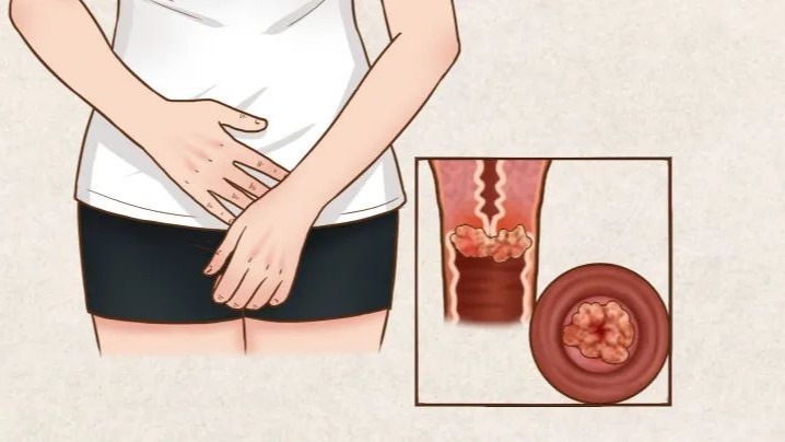 妇科疾病各种复查时间,妇科分泌物检查前需注意什么