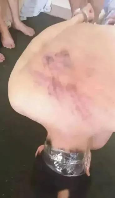 网传李赛高“挑脚筋”，他宣传的缅北你还心向往之吗？