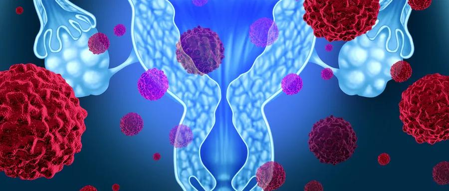 中医宫颈癌治疗方案,宫颈癌盆腔淋巴结转移治疗方案