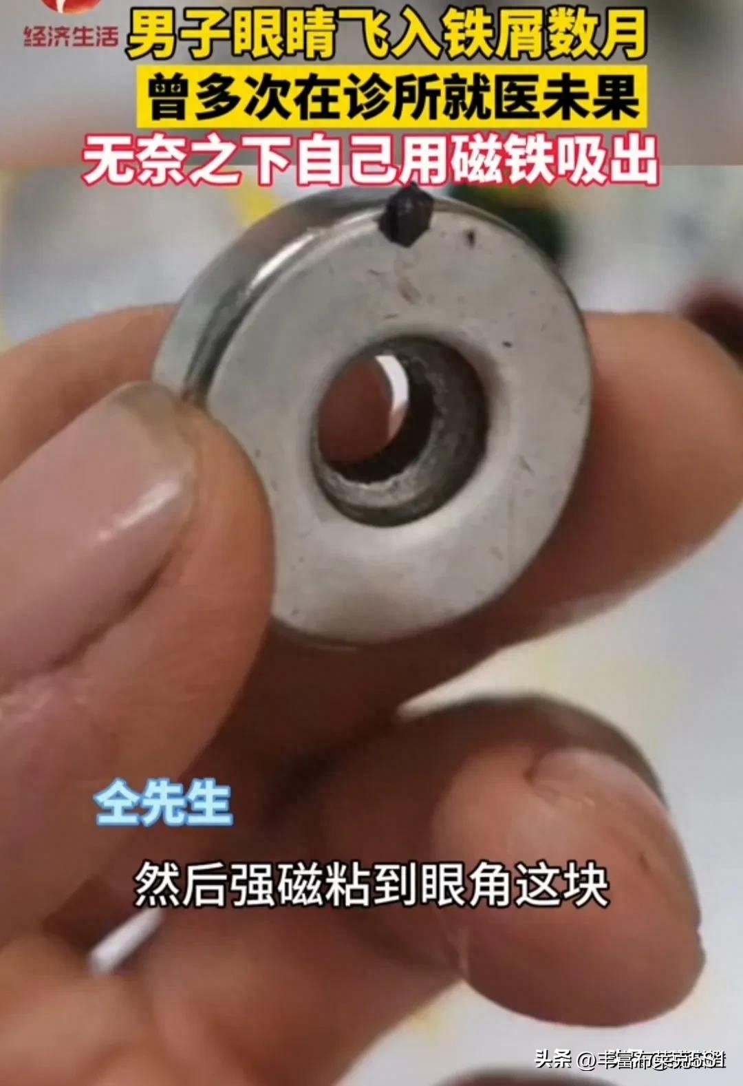 男子眼睛进铁屑抖音,男子铁屑进眼数月诊所就医未果