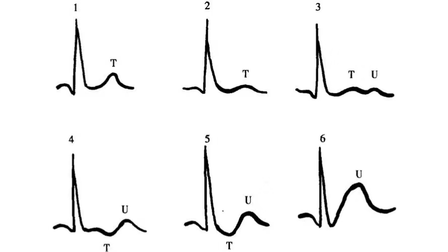 缺钾的症状与补钙的危害,缺钾和缺钙为什么要先补钾