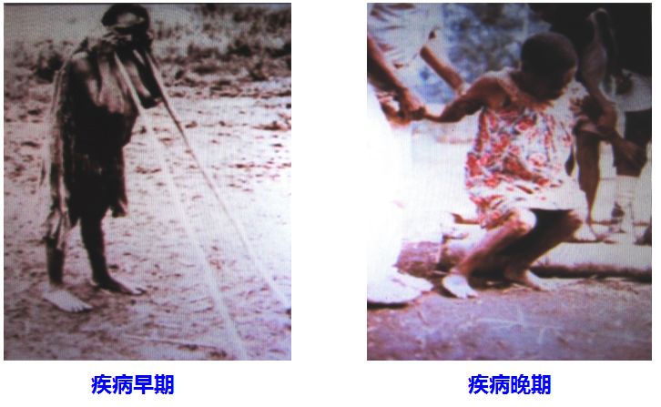 人类同类相食是怎么回事,人类基因有防止人吃人的吗