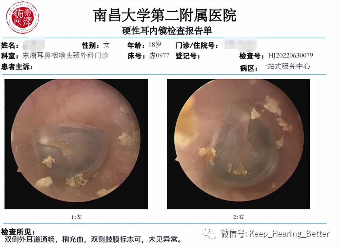 南昌大学第一附属医院鼓膜修复,南昌大学二附院耳鼻喉科专家介绍
