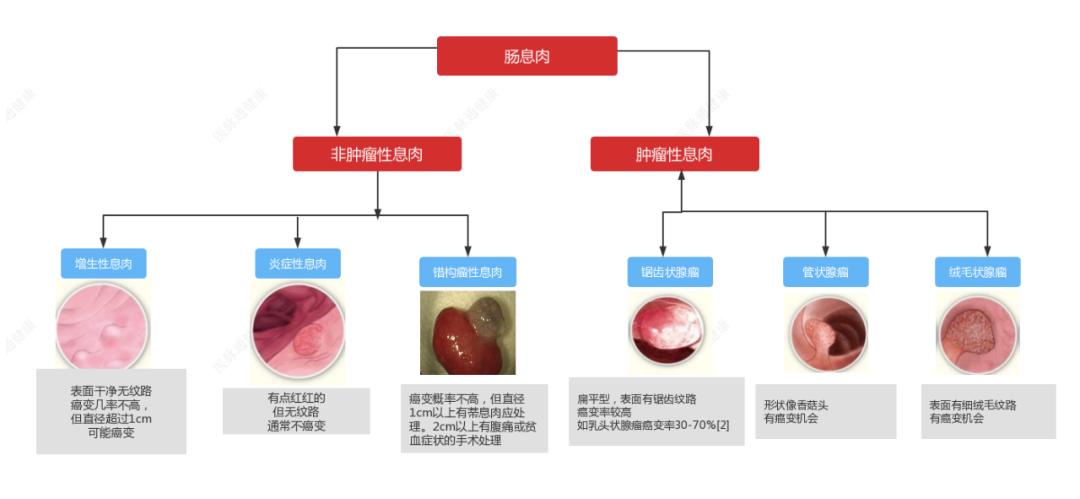 肠镜发现息肉怎么处理,肠镜能够判断出息肉和癌症吗