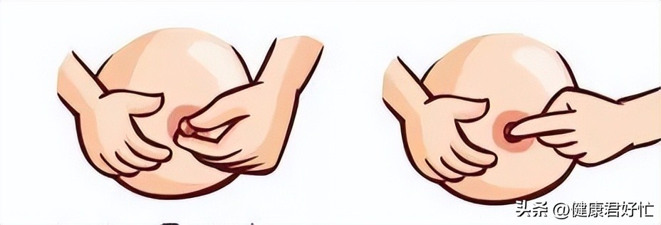 有哪些乳腺知识一定要了解,女生乳腺冷知识