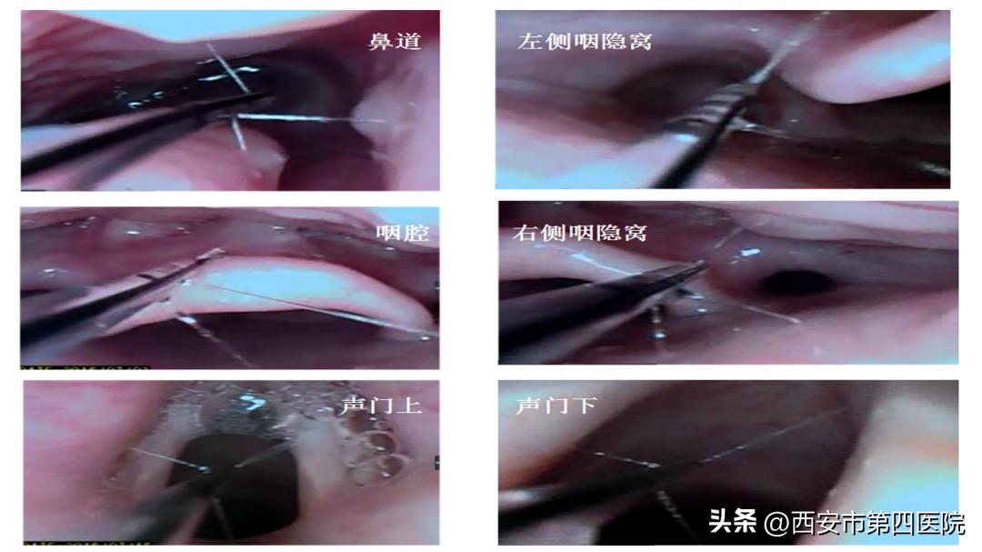 健康中国行动2030图解,健康中国行动合理标准