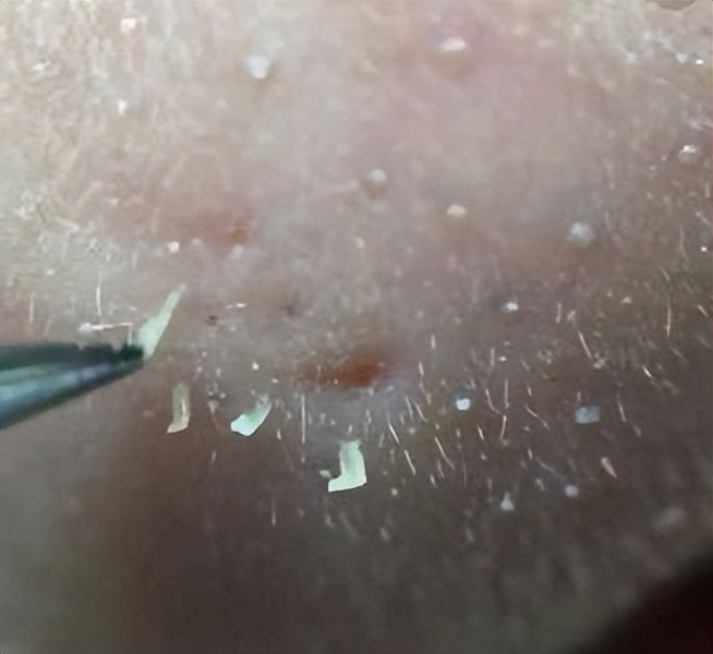 涂完粉底液鼻子上有白点,上完粉底液之后为什么鼻子有白点