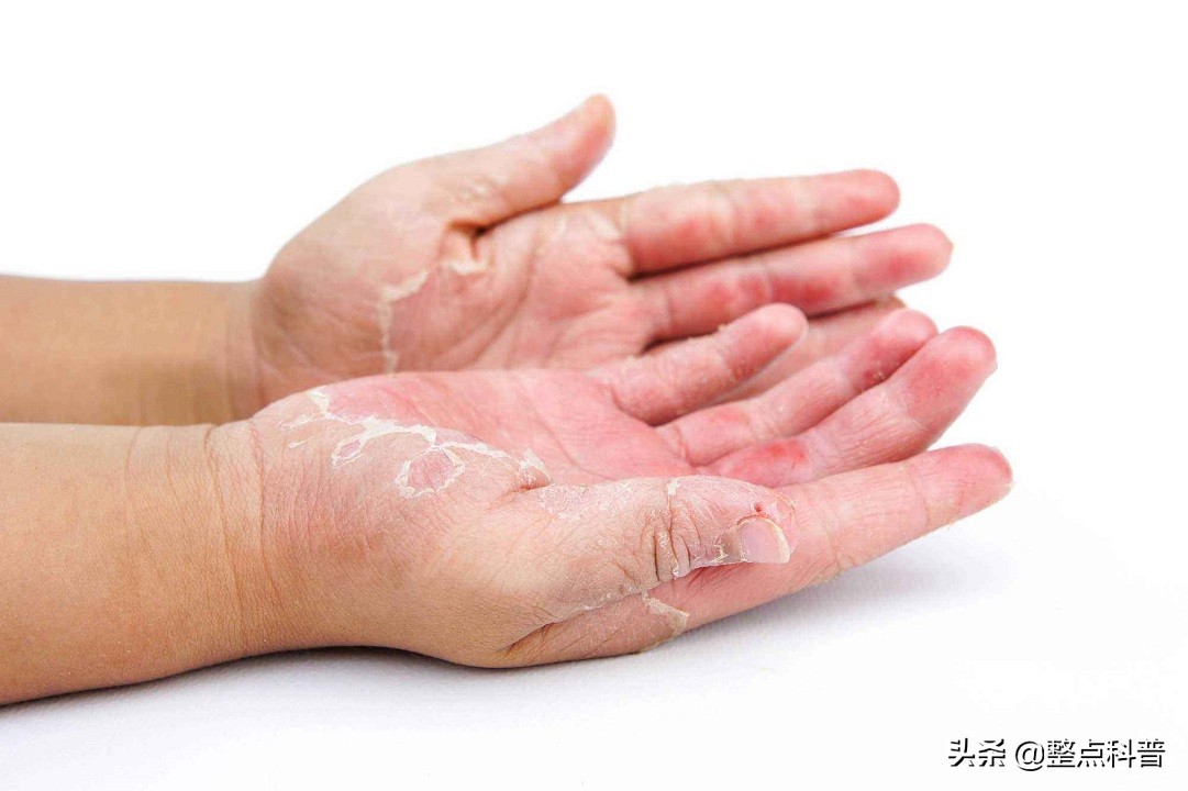 洗洁精是害人精这种说法对吗,洗洁精对人体的危害谣言