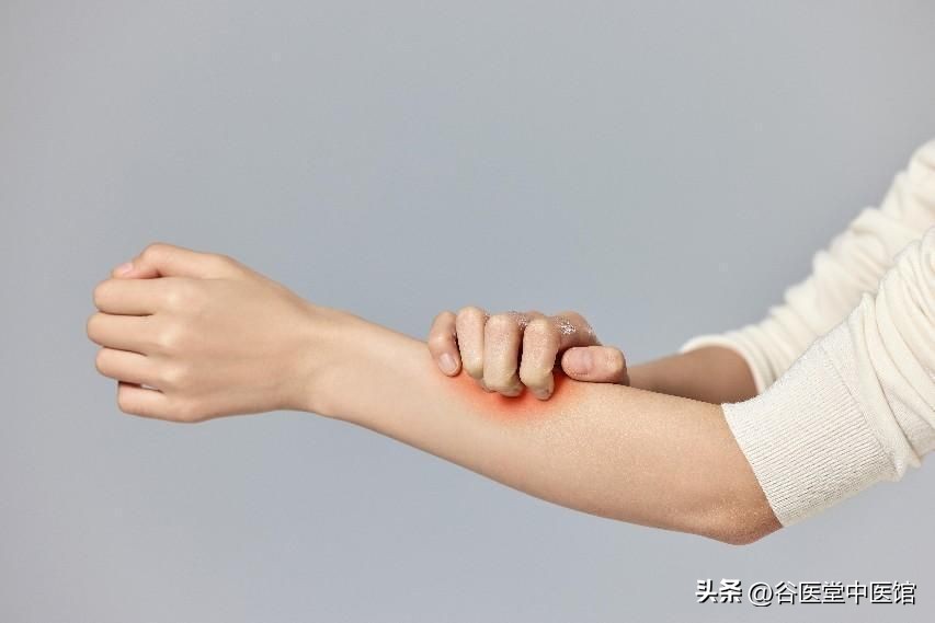 运动过敏的原因和危害,一运动皮肤就痒中医辨证