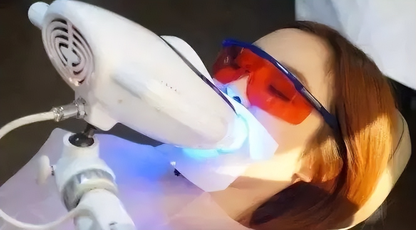 牙齿冷光美白有什么好处和优点？是永久的吗？