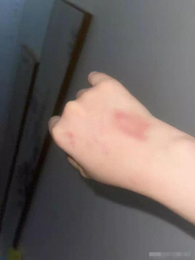 女子电梯内被大型犬咬死,女子在电梯内被自家狗撕咬