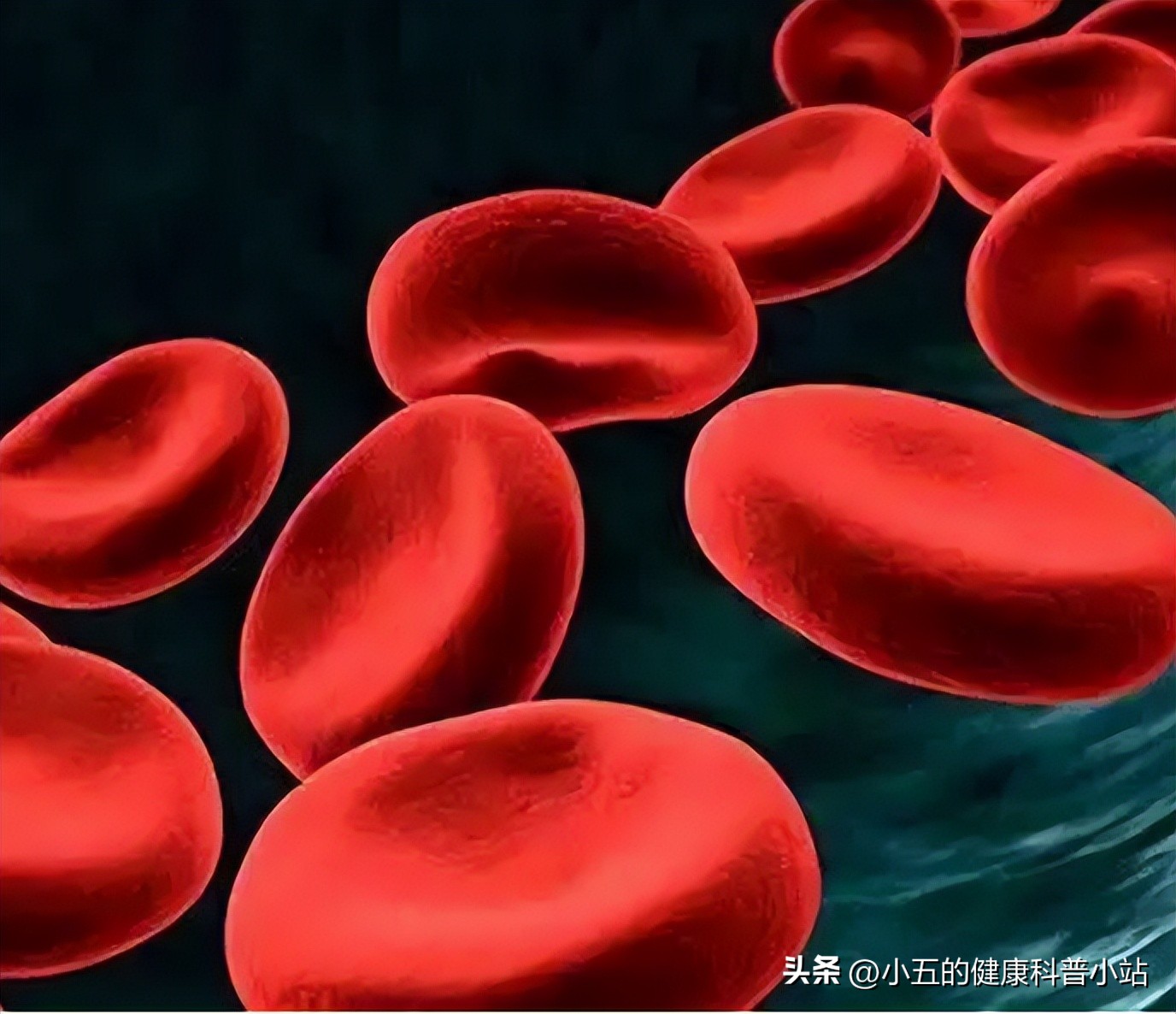 益气养血治疗贫血吗,生血宁片可以治贫血吗