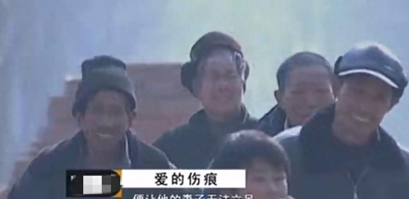 男子与妻子嬉戏时，发现妻子*处私**有伤痕，妻子：不小心被刺伤