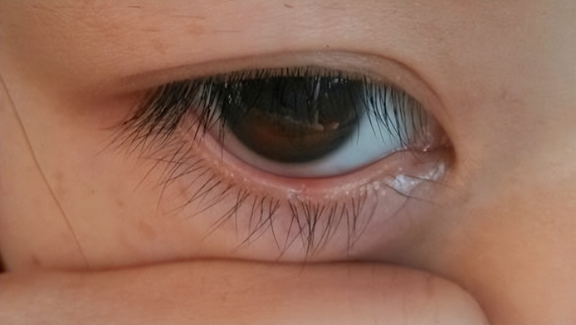 眼睛干涩有救吗,吃什么可以预防眼睛干涩模糊