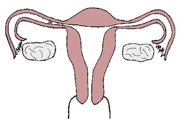 有月经无排卵怎么备孕,有月经无排卵能治好吗