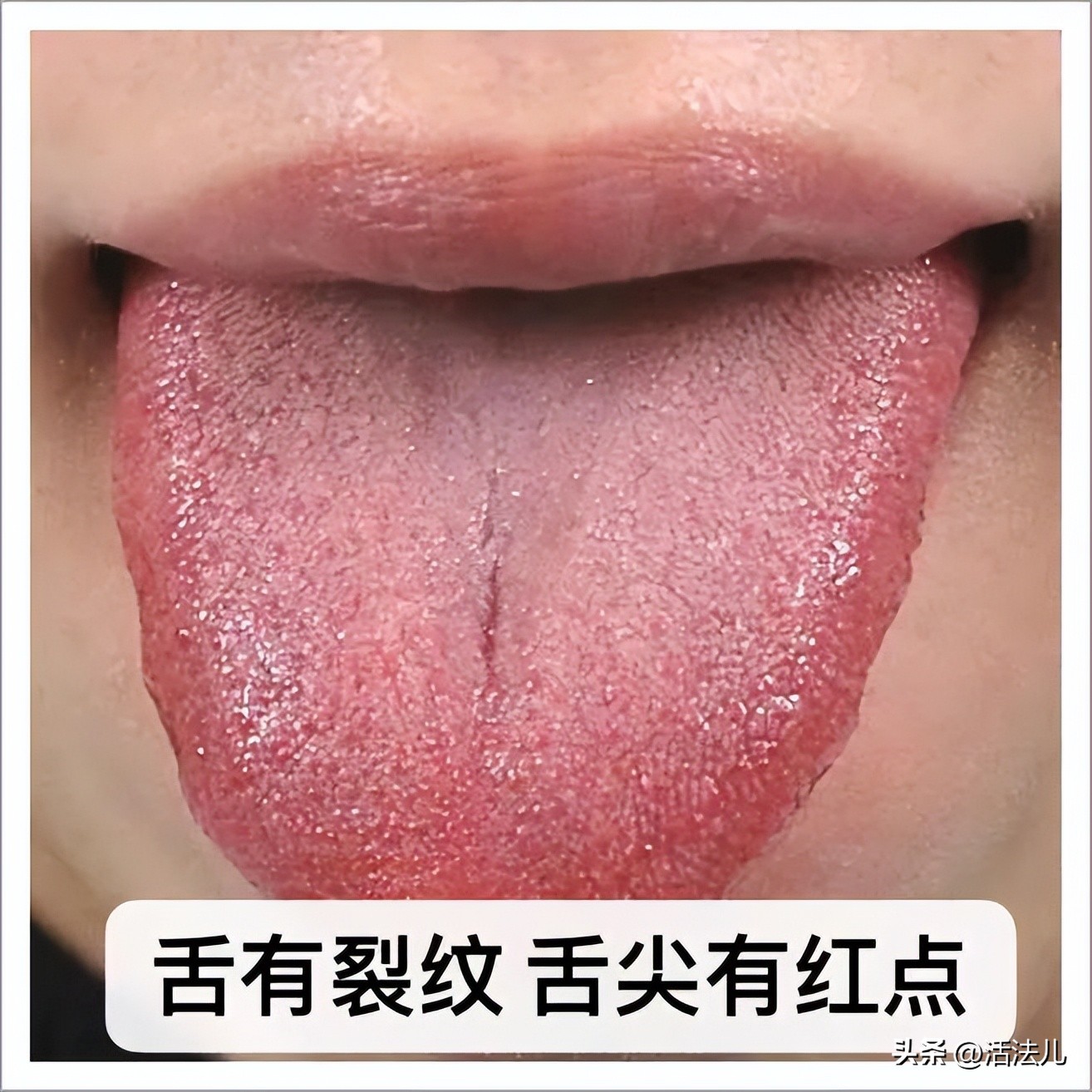 三伏天养生不动就出汗是不是祛湿,三伏天时浑身出汗怎么办