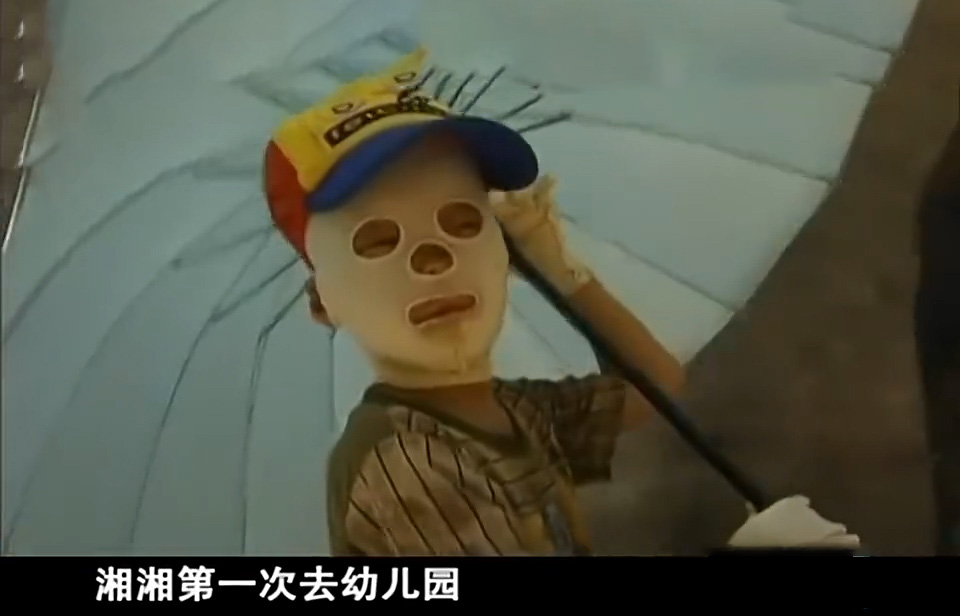 男孩因为烧伤惨遭毁容,被烧伤毁容的男孩