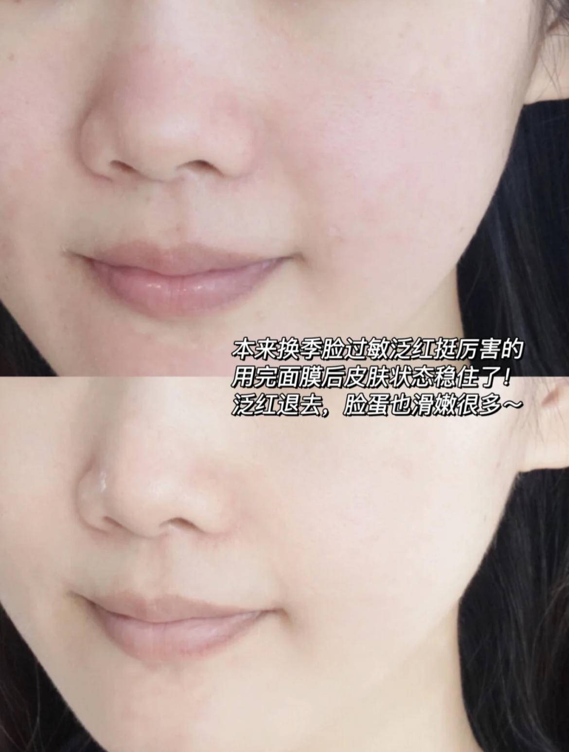 用护肤品感觉刺痛是缺水吗,护肤时刺痛是皮肤缺水吗