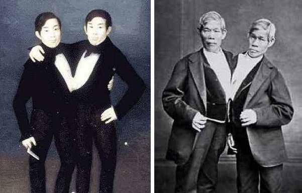 泰国连体人邦克,连体人结婚生子