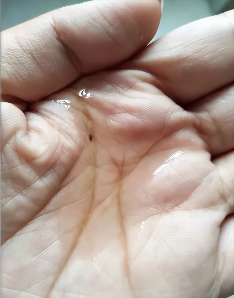 6款妊娠油推荐,妊娠油乳