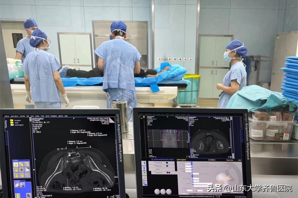 儿童微创手术全麻,儿童局灶性癫痫电极植入