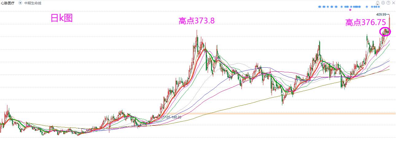 短线操作最佳买点,常用买点技巧讲解