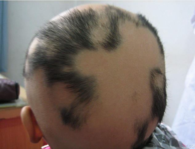 揭秘民间鬼剃头,贵州农村发现鬼剃头