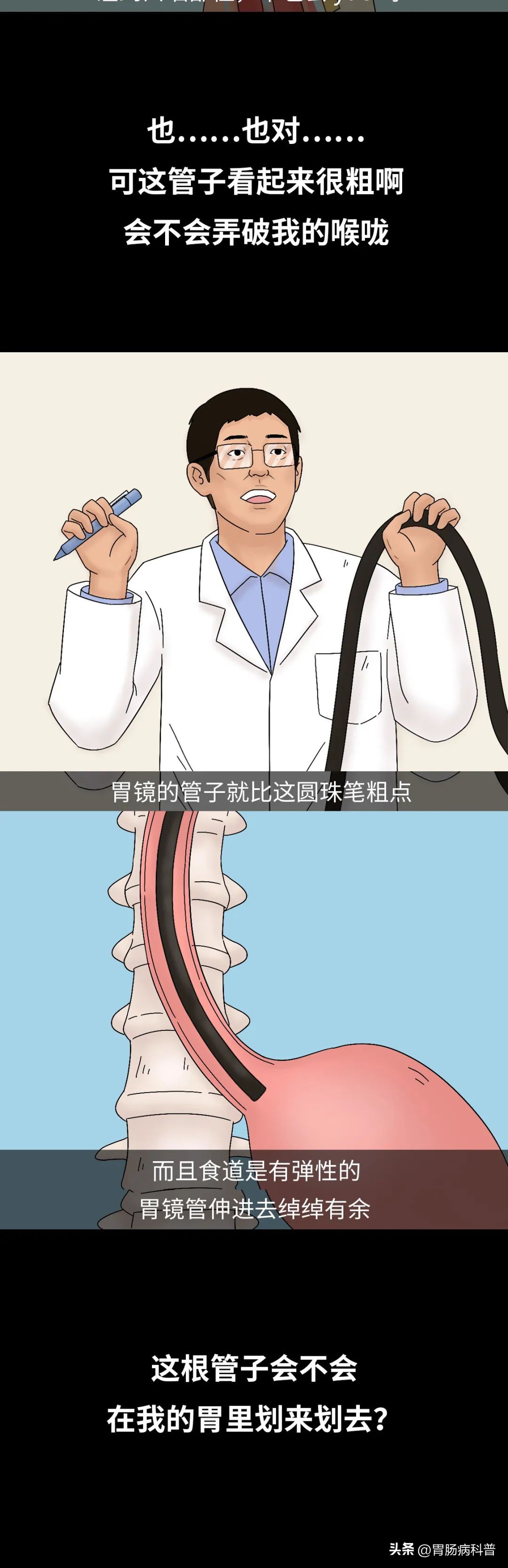 胃镜怎么做的全过程示意图,胃镜检查视频第一视角了解