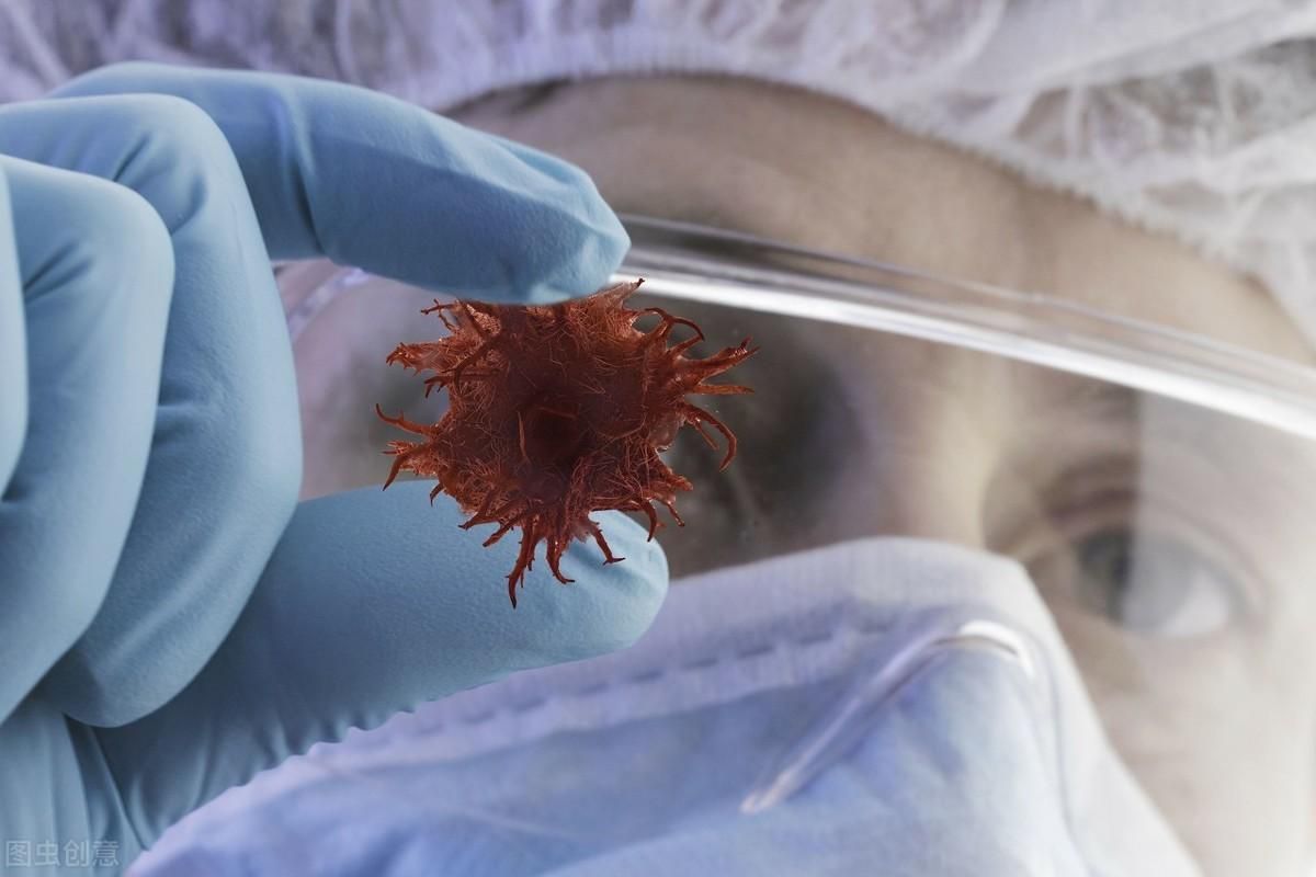 腺癌的症状和前兆,转移性腺癌属于什么癌症