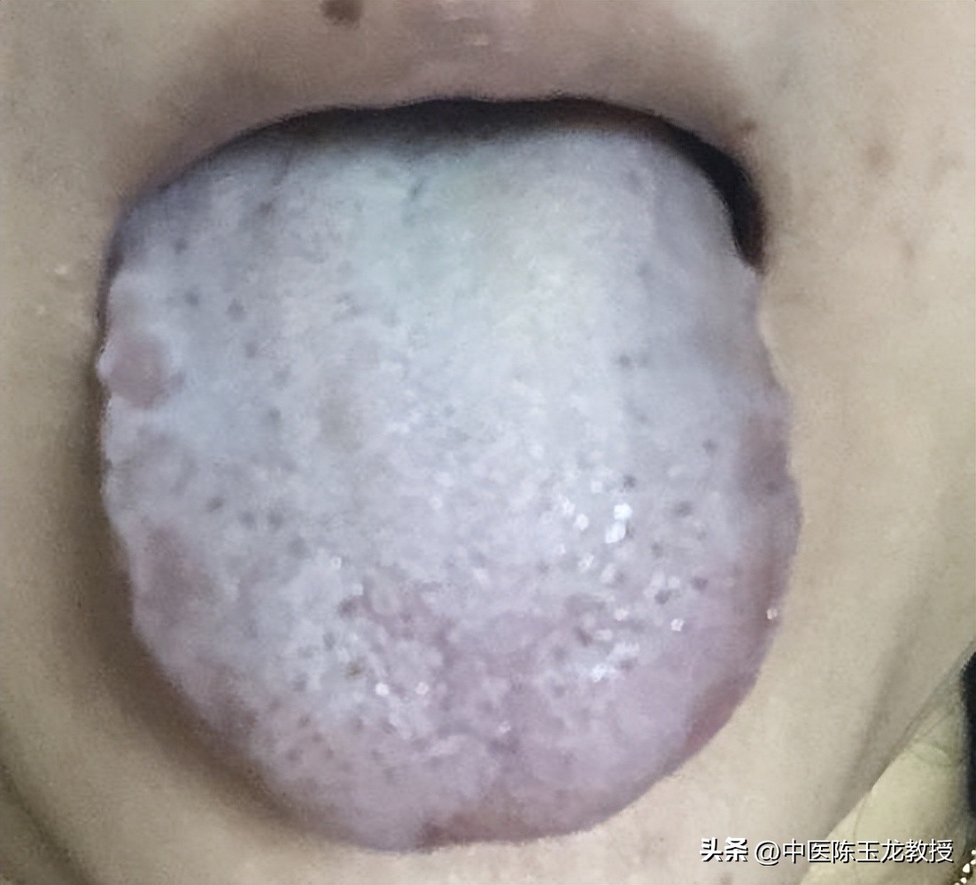 胃病引起的腹泻吃什么药管用,老中医治腹泻最快的方法